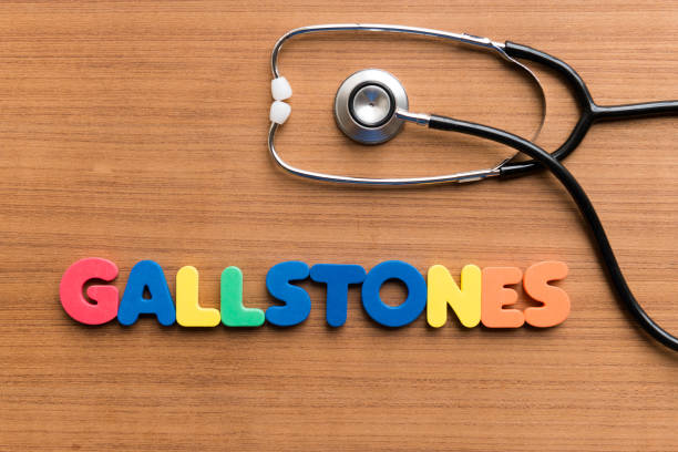 gallstones