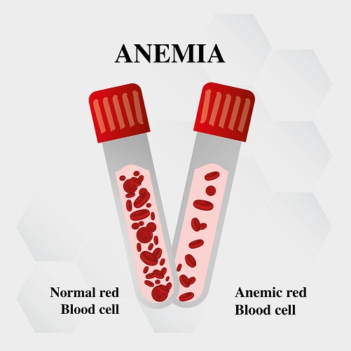 anemia blood cell