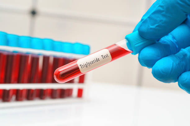 Triglyceride blood test